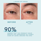 Woman's skin before and after using Indie Lee I-Waken Eye Serum
